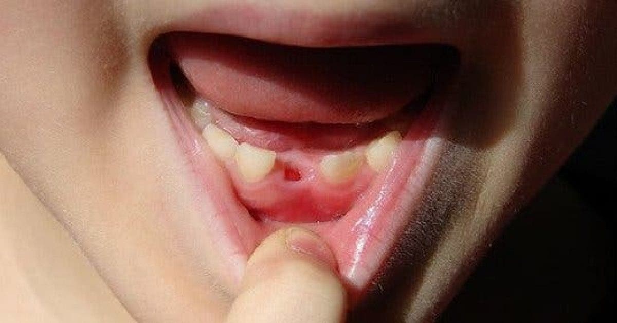 Le docteur prévient les parents : ne jetez jamais les dents de lait de votre enfant