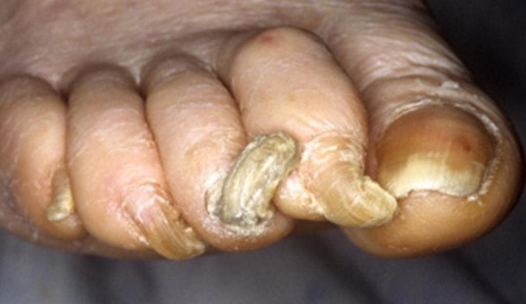 photos de femmes qui possèdent les ongles les plus étranges de la planète