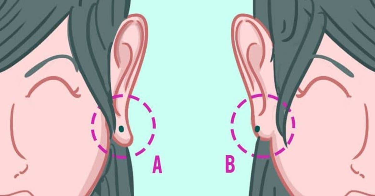 quest-ce-que-cela-signifie-si-vos-lobes-doreilles-sont-attaches-ou-detaches