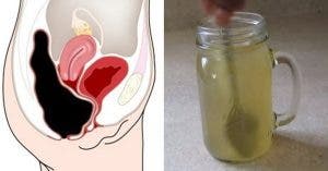 recette melangez du miel et du vinaigre de cidre pour vider votre colon des toxines 1