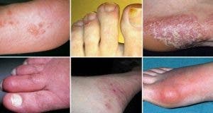 regardez vos pieds voici 10 signes qui peuvent indiquer un probleme de sante 2 1