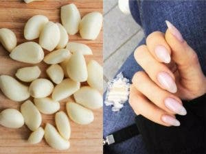 10 remèdes maison qui peuvent faire des merveilles pour vos ongles