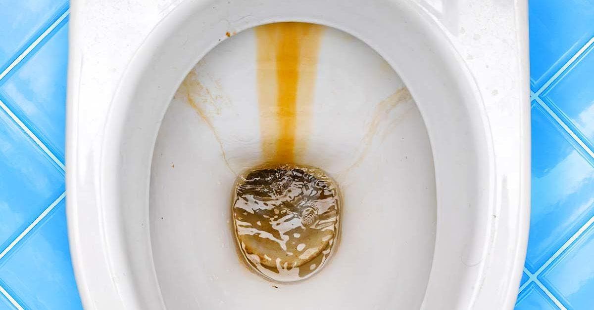 siteComment éliminer les taches marrons des toilettes_