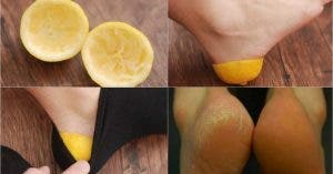 une ancienne astuce au citron pour soigner les talons rugueux et fissures en 30 minutes 1 1