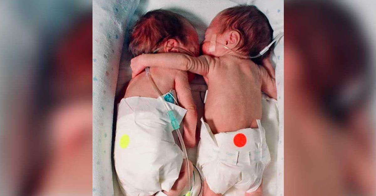 une-infirmiere-met-un-bebe-mourant-a-cote-de-son-jumeau