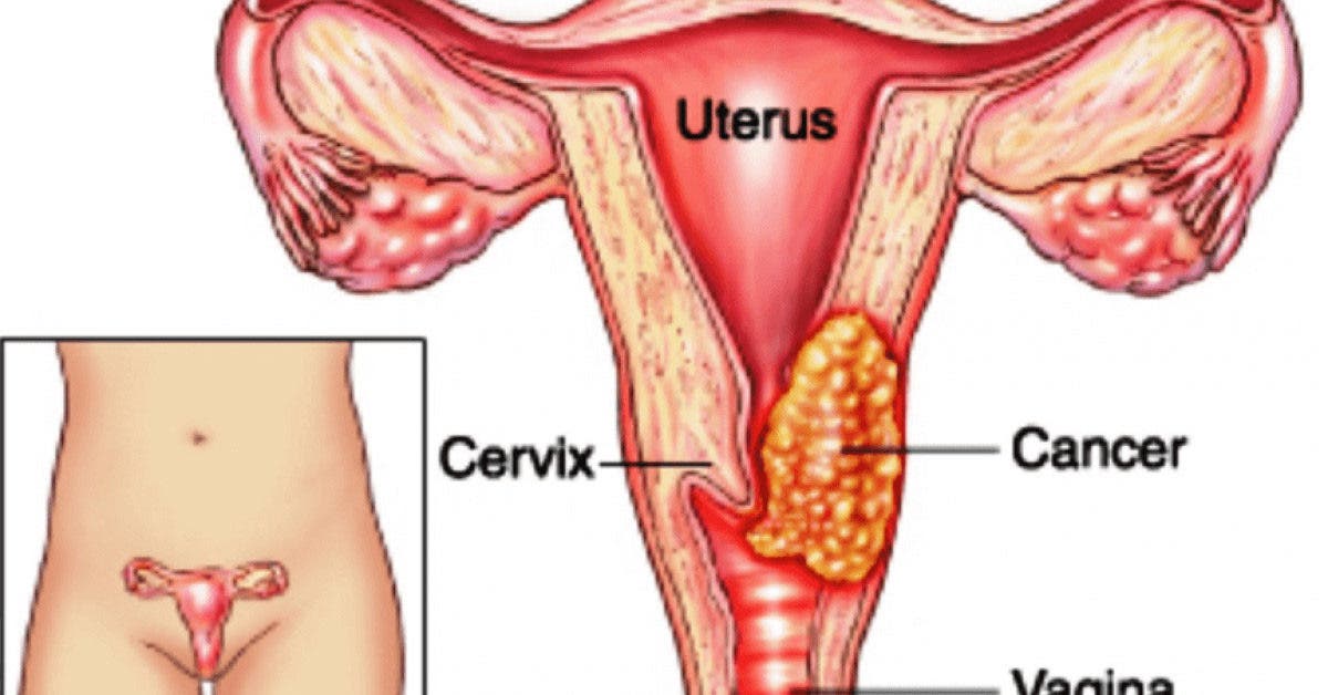 uteros
