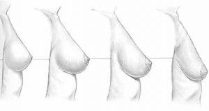 voici comment prevenir laffaissement des seins naturellement 1