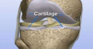 voici comment regenerer le cartilage du genou 1