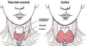 voici comment un mauvais transit intestinal peut provoquer un dereglement de la thyroide et 6 astuces pour y remedier 1