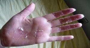 vos mains pelent voici des remedes efficaces pour retrouver une peau de bebe 1
